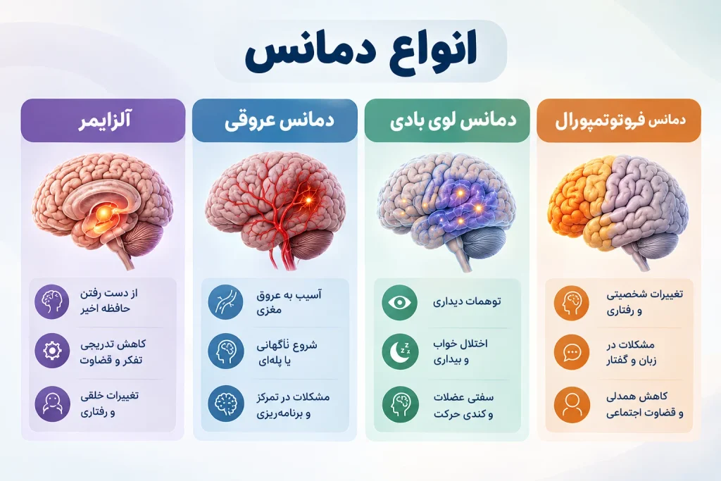 انواع دمانس