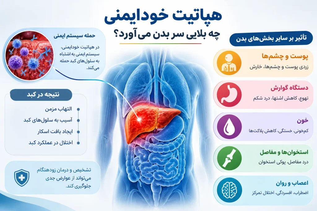 هپاتیت خودایمنی